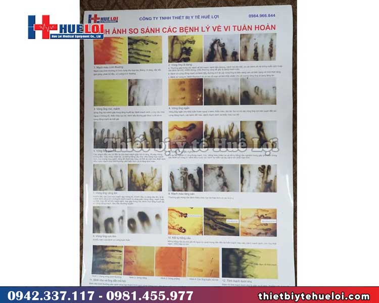Kính hiển vi soi mạch máu độ phân giải cao